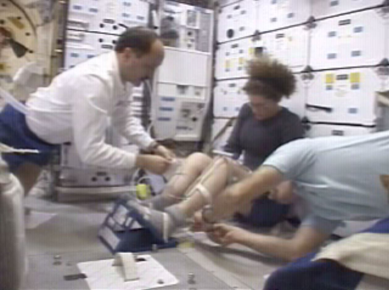Les premiers sujets de H-Reflex, les astronautes Susan Helms, James Voss et le cosmonaute    Iouri Ousachev de l'équipage d'Expedition 2, ont réalisé en 2001 l'expérience à trois reprises au cours de leur séjour de 167 jours à bord de la station spatiale.
